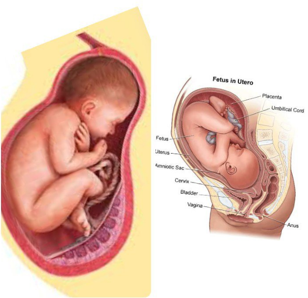 labelled foetus